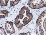 AK4 Antibody in Immunohistochemistry (Paraffin) (IHC (P))