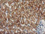 AK4 Antibody in Immunohistochemistry (Paraffin) (IHC (P))