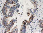 AK4 Antibody in Immunohistochemistry (Paraffin) (IHC (P))