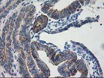 AK4 Antibody in Immunohistochemistry (Paraffin) (IHC (P))