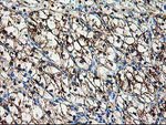 AK4 Antibody in Immunohistochemistry (Paraffin) (IHC (P))