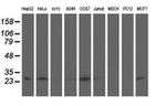 AK4 Antibody in Western Blot (WB)