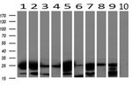 AK4 Antibody in Western Blot (WB)