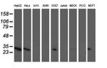 AK4 Antibody in Western Blot (WB)