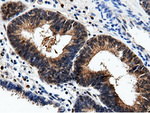 AK5 Antibody in Immunohistochemistry (Paraffin) (IHC (P))