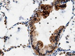 AK5 Antibody in Immunohistochemistry (Paraffin) (IHC (P))