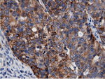 AK5 Antibody in Immunohistochemistry (Paraffin) (IHC (P))