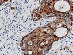 AK5 Antibody in Immunohistochemistry (Paraffin) (IHC (P))