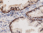 AK5 Antibody in Immunohistochemistry (Paraffin) (IHC (P))