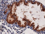 AK5 Antibody in Immunohistochemistry (Paraffin) (IHC (P))