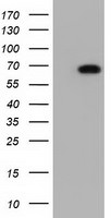 AK5 Antibody in Western Blot (WB)