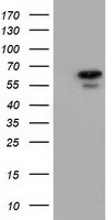 AK5 Antibody in Western Blot (WB)