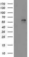 AK5 Antibody in Western Blot (WB)