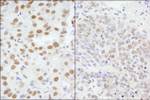 AKAP8/AKAP95 Antibody in Immunohistochemistry (IHC)