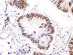 AKAP8L/HA95 Antibody in Immunohistochemistry (IHC)