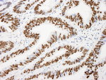 AKAP8L/HA95 Antibody in Immunohistochemistry (IHC)