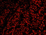 AKAP8L/HA95 Antibody in Immunohistochemistry (IHC)