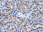 AKR1A1 Antibody in Immunohistochemistry (Paraffin) (IHC (P))