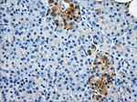 AKR1A1 Antibody in Immunohistochemistry (Paraffin) (IHC (P))