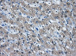 AKR1A1 Antibody in Immunohistochemistry (Paraffin) (IHC (P))