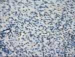 AKR1A1 Antibody in Immunohistochemistry (Paraffin) (IHC (P))