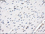 AKR1A1 Antibody in Immunohistochemistry (Paraffin) (IHC (P))