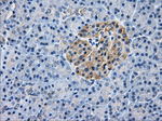 AKR1A1 Antibody in Immunohistochemistry (Paraffin) (IHC (P))