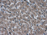 AKR1A1 Antibody in Immunohistochemistry (Paraffin) (IHC (P))