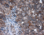 AKR1A1 Antibody in Immunohistochemistry (Paraffin) (IHC (P))