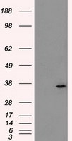 AKR1A1 Antibody in Western Blot (WB)