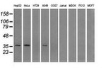 AKR1A1 Antibody in Western Blot (WB)