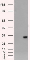 AKR1A1 Antibody in Western Blot (WB)