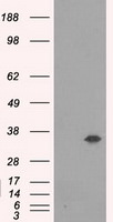 AKR1A1 Antibody in Western Blot (WB)