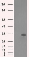 AKR1A1 Antibody in Western Blot (WB)