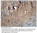 AKT1 Antibody in Immunohistochemistry (IHC)