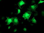 AKT1 Antibody in Immunocytochemistry (ICC/IF)