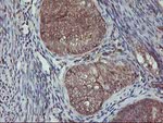 AKT1 Antibody in Immunohistochemistry (Paraffin) (IHC (P))