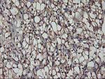 AKT1 Antibody in Immunohistochemistry (Paraffin) (IHC (P))