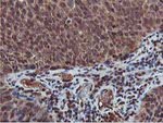 AKT1 Antibody in Immunohistochemistry (Paraffin) (IHC (P))