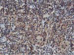 AKT1 Antibody in Immunohistochemistry (Paraffin) (IHC (P))