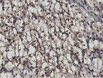 AKT1 Antibody in Immunohistochemistry (Paraffin) (IHC (P))