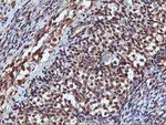 AKT1 Antibody in Immunohistochemistry (Paraffin) (IHC (P))