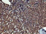 AKT1 Antibody in Immunohistochemistry (Paraffin) (IHC (P))