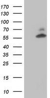 AKT1 Antibody in Western Blot (WB)