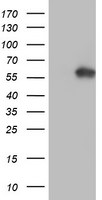 AKT1 Antibody in Western Blot (WB)