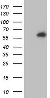 AKT1 Antibody in Western Blot (WB)