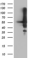 AKT1 Antibody in Western Blot (WB)