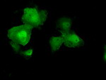 AKT2 Antibody in Immunocytochemistry (ICC/IF)