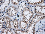 AKT2 Antibody in Immunohistochemistry (Paraffin) (IHC (P))