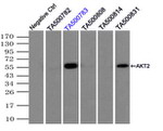 AKT2 Antibody in Immunoprecipitation (IP)